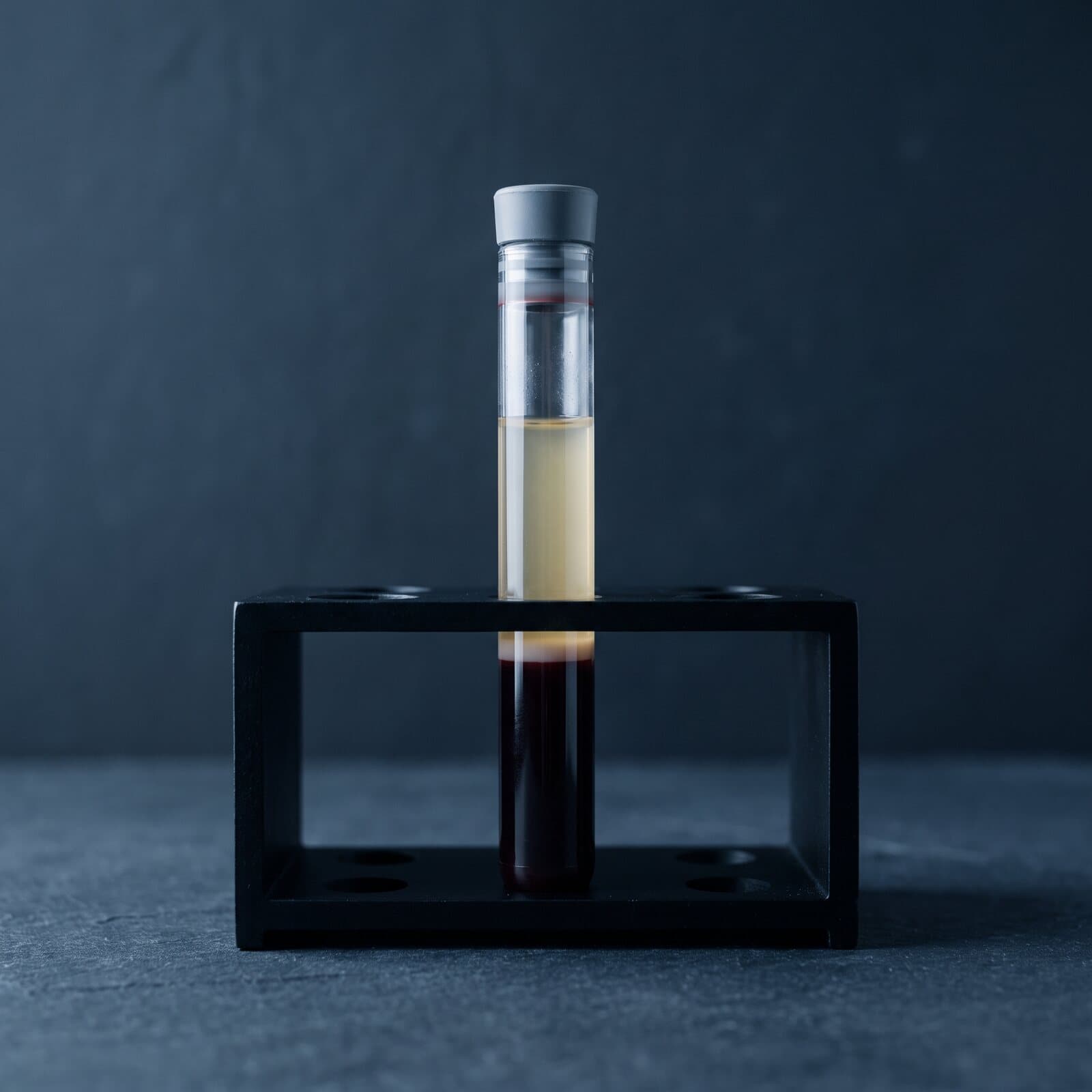 A spun blood tube with red cells below, a thin white layer, and straw-colored plasma on top