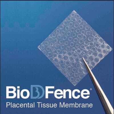 BioDFence placental tissue membrane held with forceps
